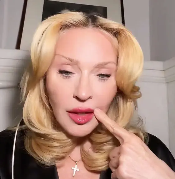 Αντιδράσεις για τα grills στα δόντια της Madonna - «Αυτό σίγουρα κοστίζει περισσότερο από το αυτοκίνητό μου»