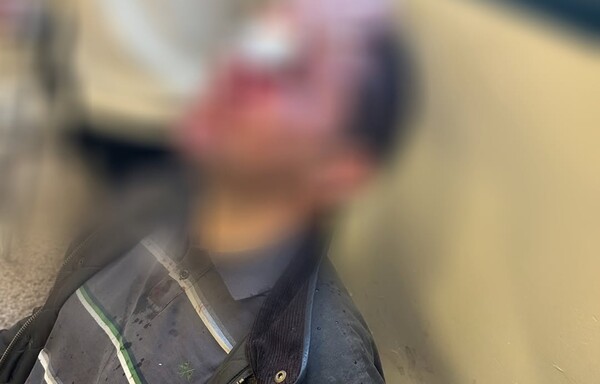 Εισβολή κουκουλοφόρων στη Νομική: Πώς έγινε η επίθεση - «Δεν έχω ξαναδεί τόση βία»