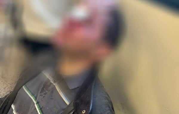 Ευθύνες στην ΕΛ.ΑΣ. αποδίδει το ΕΚΠΑ για την αιματηρή επίθεση κουκουλοφόρων στη Νομική 