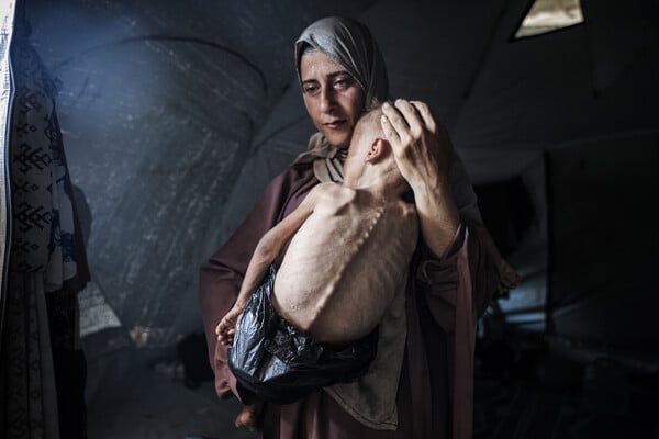 «Υπάρχει στα αλήθεια λιμός στη Γάζα» λέει τώρα ο Τραμπ 