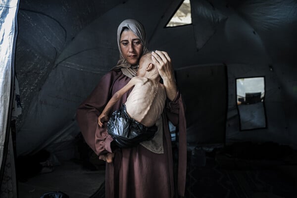 «Τράβηξα τη φωτογραφία ενώ λιμοκτονούσα κι ο ίδιος»: Η ιστορία της εικόνας-σύμβολο του λιμού στη Γάζα 