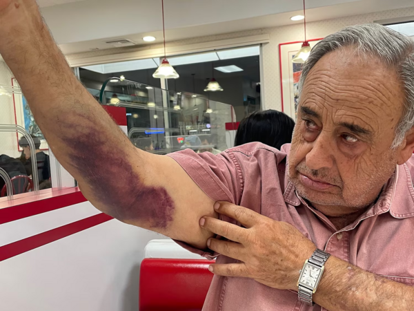 ΗΠΑ: 79χρονος πολίτης καταγγέλλει πράκτορες της ICE για βίαιη επίθεση – Ζητά 50 εκατ. δολάρια