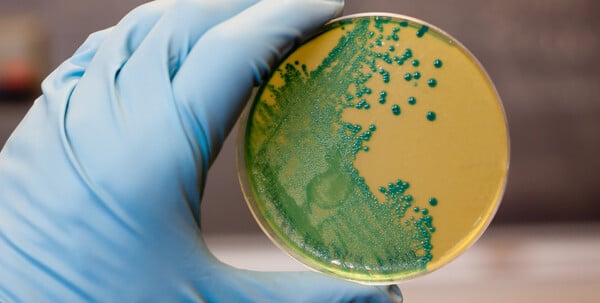 Τι συμβαίνει στις ΗΠΑ με την επιδημία λιστέριας – Ανακαλούνται έτοιμα γεύματα ζυμαρικών