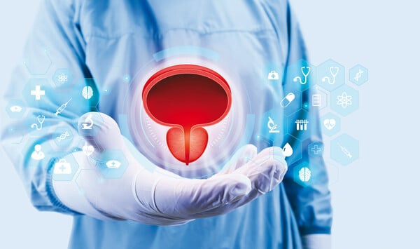 MiLEP, η νέα τεχνολογία στη θεραπεία της καλοήθους υπερπλασίας του προστάτη