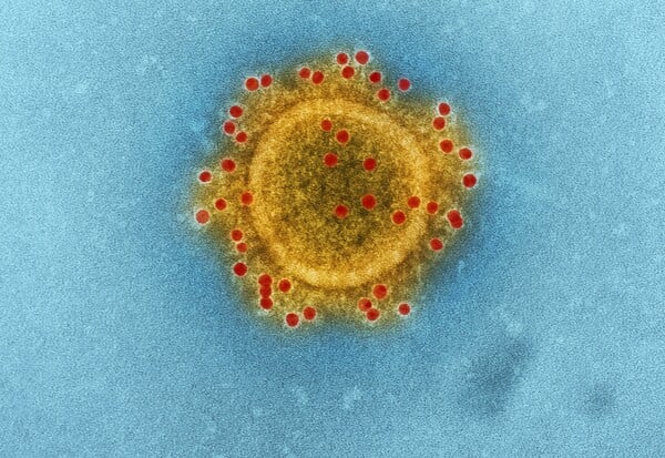 ΓΡΙΠΗ ΠΤΗΝΩΝ COVID