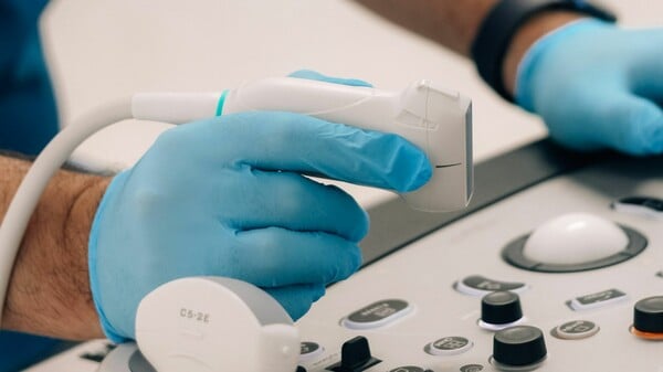 ΓΙΑ Σ/Κ: Πώς ένας απλός υπέρηχος λαιμού μπορεί να εντοπίσει τον κίνδυνο καρδιακής προσβολής και εγκεφαλικού