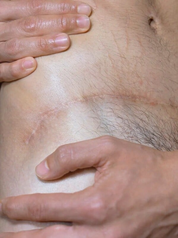 Όταν ο κόσμος καίγεται πιο γρήγορα από εμάς/ από τον Πάνο Μιχαήλ