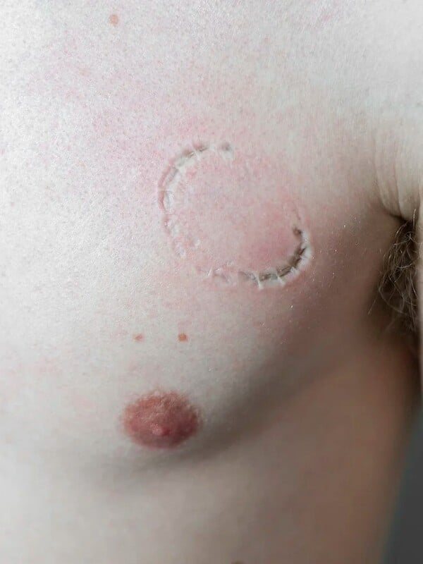 Όταν ο κόσμος καίγεται πιο γρήγορα από εμάς/ από τον Πάνο Μιχαήλ