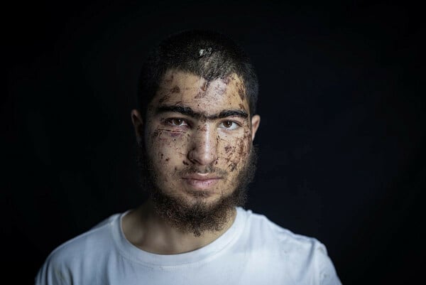 Ανατομία μιας απαγωγής από έποικους 