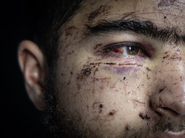 Ανατομία μιας απαγωγής από έποικους 