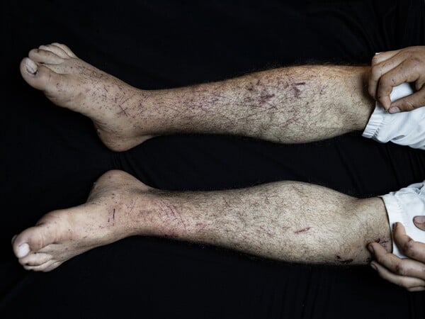 Ανατομία μιας απαγωγής από έποικους 