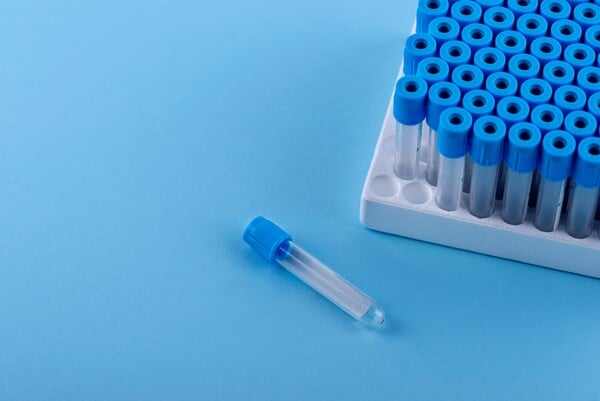 Γιατί δεν εντοπίστηκε το καρκινικό γονίδιο στο σπέρμα δότη που χρησιμοποιήθηκε για τη σύλληψη 197 παιδιών