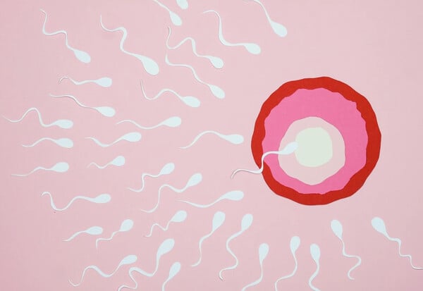 ΣΠΕΡΜΑ ΔΟΤΗ ΚΑΡΚΙΝΙΚΟ ΓΟΝΙΔΙΩΜΑ