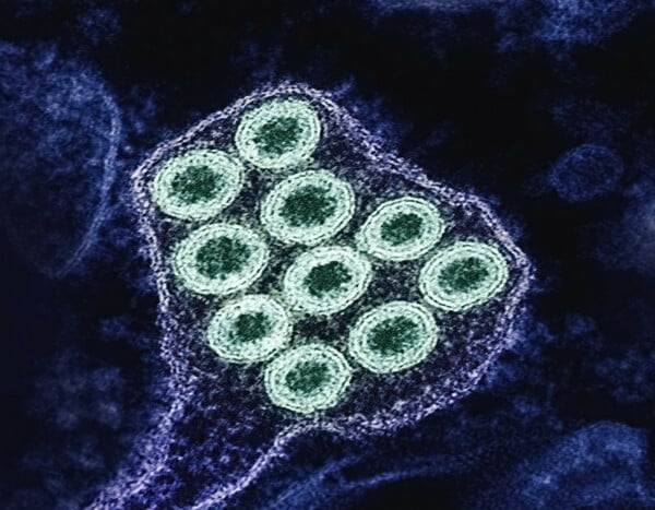 Η «υπεργρίπη» σαρώνει την Ευρώπη - Αυξάνεται η πίεση στα συστήματα υγείας προειδοποιεί ο ΠΟΥ