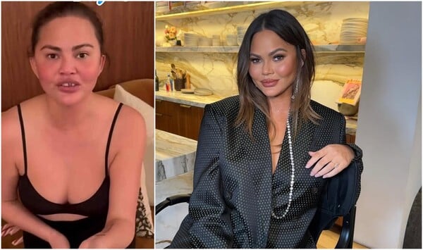 «Μου έπεσε το δόντι» - Το ατύχημα της Κρίσι Τέιγκεν ενώ έπαιζε με τα παιδιά της