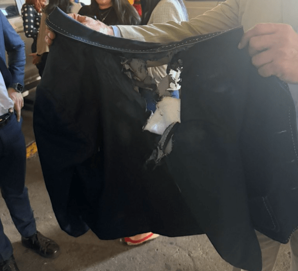 Ονδούρα: Επίθεση σε βουλεύτρια με αυτοσχέδιο εκρηκτικό μηχανισμό - Την πέτυχε στο κεφάλι 