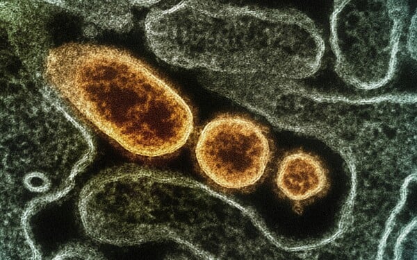 Γρίπη: Δεκάδες κρούσματα στα νοσοκομεία - Κυριαρχεί η υποπαραλλαγή Κ