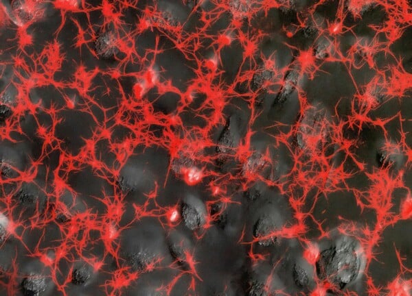 ΚΟΡΩΝΟΙΟΣ ΠΝΕΥΜΟΝΕΣ ΜΕΛΕΤΗ