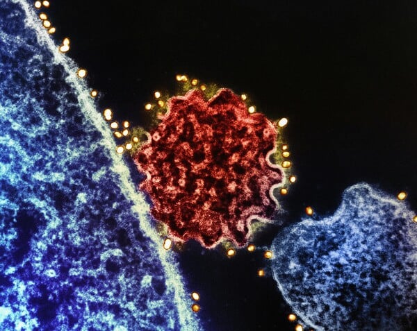 NIPAH ΙΟΣ ΠΑΓΚΟΣΜΙΟΣ ΟΡΓΑΝΙΣΜΟΣ ΥΓΕΙΑΣ