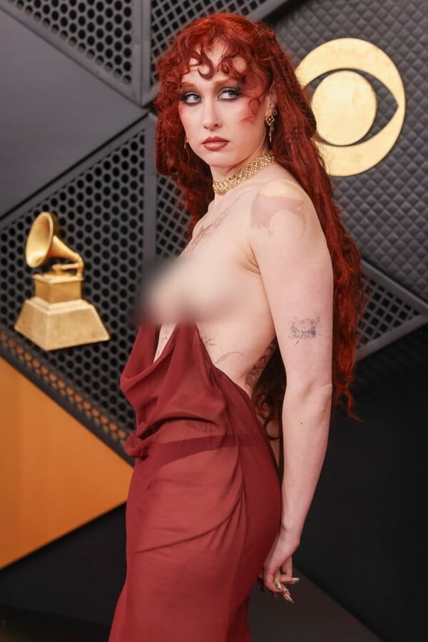 CHAPPELL ROAN GRAMMY 2026 ΕΜΦΑΝΙΣΗ ΤΟΛΜΗΡΗ