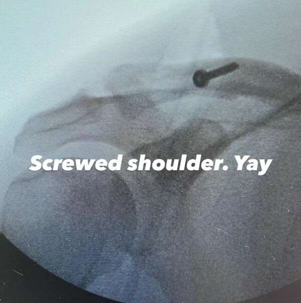 ΤΣΑΝΙΝΓΚ ΤΕΪΤΟΥΜ ΤΡΑΥΜΑΤΙΣΜΟΣ ΝΟΣΟΚΟΜΕΙΟ