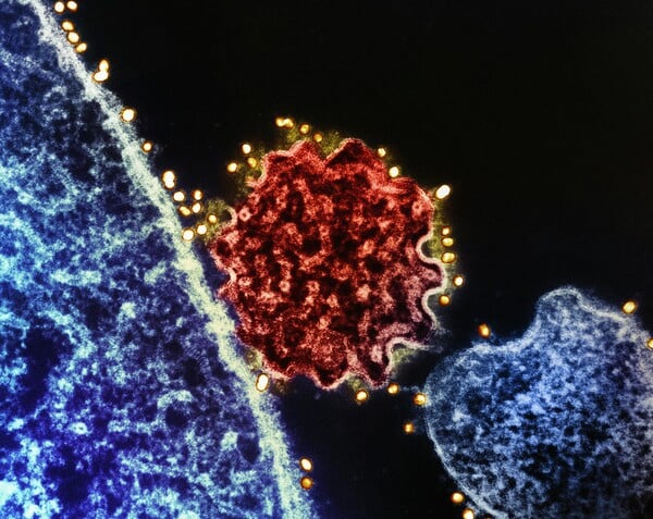 NIPAH ΙΟΣ ΜΠΑΝΓΚΛΑΝΤΕΣ