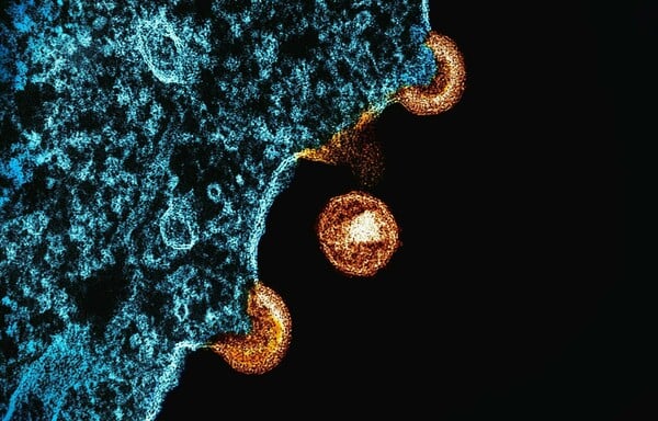 HIV ΘΕΡΑΠΕΙΑ ΧΑΠΙ