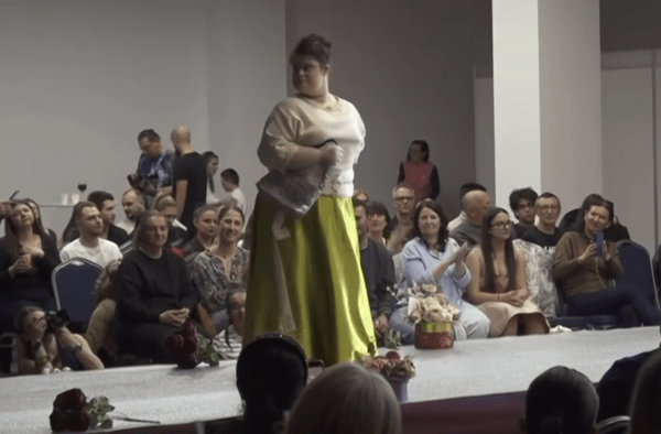 ΣΥΝΔΡΟΜΟ DOWN ΠΑΣΑΡΕΛΑ ΕΠΙΔΕΙΞΗ ΜΟΔΑΣ