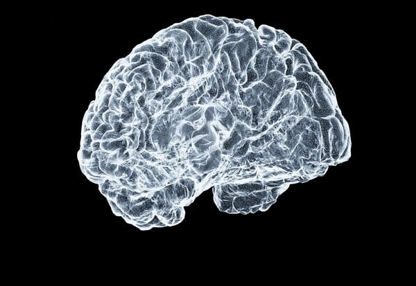 ΑΝΕΥΡΥΣΜΑ ΕΓΚΕΦΑΛΟΥ ΤΙ ΕΙΝΑΙ ΠΩΣ ΑΝΑΓΝΩΡΙΖΕΤΑΙ