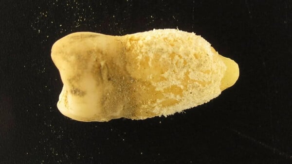 ΜΟΥΜΙΑ ΔΟΝΤΙ ΟΣΤΡΑΚΙΑ