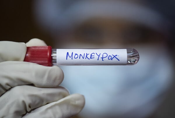 MPOX ΗΠΑ ΕΡΕΥΝΗΤΕΣ ΙΟΣ