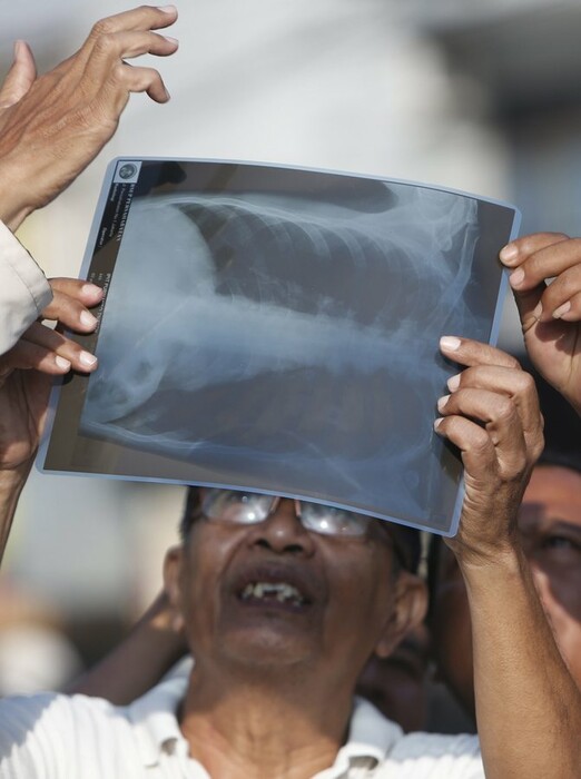 Θεαματικές εικόνες από την Ινδονησία και την ολική έκλειψη ηλίου