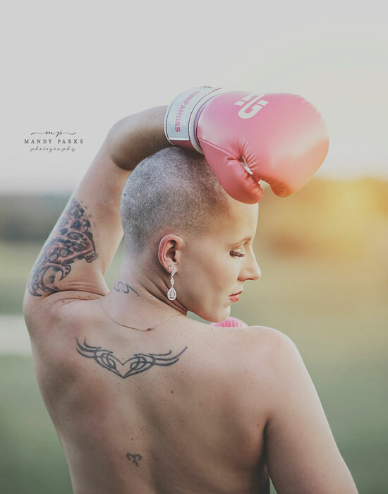 Η μάχη με τον καρκίνο του στήθους σε μια viral φωτογράφηση