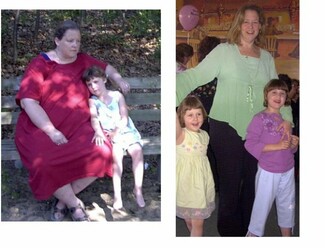 Φωτογραφίες ατόμων πριν και μετά την απώλεια βάρους