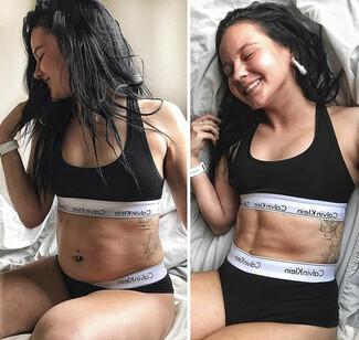 Νεαρή fitness blogger αποκαλύπτει τι (πραγματικά) συμβαίνει με όλα αυτά τα τέλεια σώματα στο Instagram