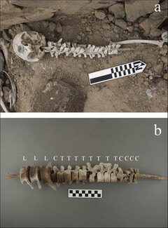«Συναρμολογώντας τους νεκρούς»: Γιατί οι αυτόχθονες του Περού «έδεναν» τους σπονδύλους των σκελετών; 
