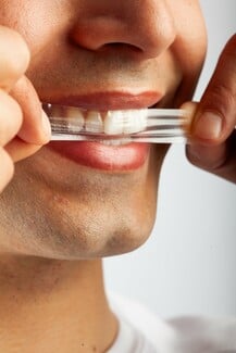PopSmile Whitening Strips: Η νέα εποχή στη λεύκανση δοντιών χωρίς ευαισθησίες