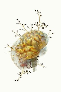 «Phytobiosomes»:Η έκθεση του Costas Picadas συνδυάζει την τέχνη με την υγεία