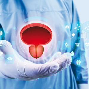 MiLEP, η νέα τεχνολογία στη θεραπεία της καλοήθους υπερπλασίας του προστάτη