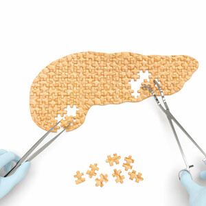 Βιβλιάριο παρακολούθησης, το νέο εργαλείο για τους κυστικούς όγκους του παγκρέατος