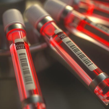 Δωρεάν οι γενετικές εξετάσεις σε καρκινοπαθείς μέσω του Δικτύου Ιατρικής Ακριβείας