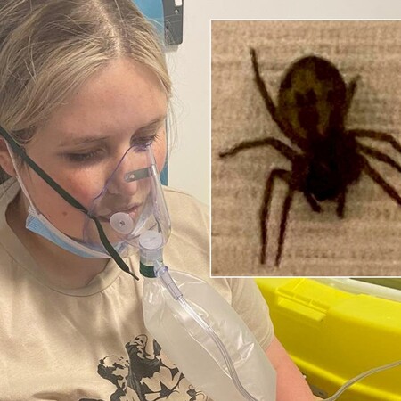 Ουαλία: 18χρονη κατέληξε στο χειρουργείο έπειτα από τσίμπημα «τεράστιας» αράχνης