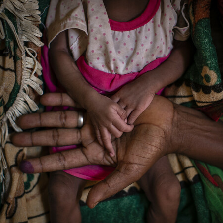 ΟΗΕ: Υποσιτισμός άνευ προηγουμένου πλήττει τις έγκυες και τις γυναίκες που θηλάζουν, στο Τιγκράι