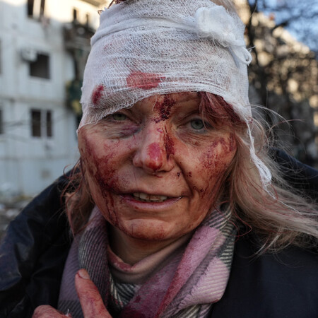 ukraine wounded woman