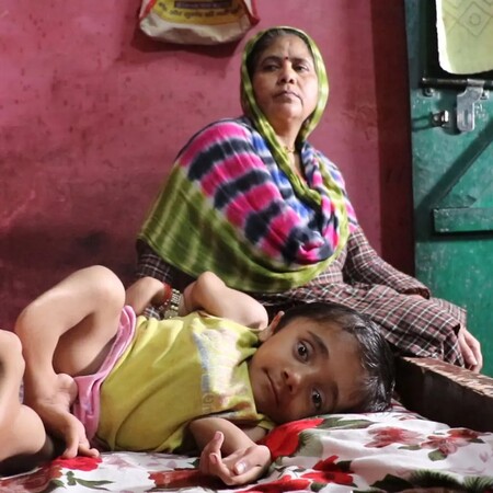 Το «αγόρι από γυαλί» έχει σπάσει 100 οστά λόγω σπάνιας ασθένειας- και είναι μόλις 12