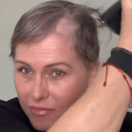 Ξύρισε το κεφάλι της η Νικόλ Έγκερτ που μάχεται τον καρκίνο του μαστού