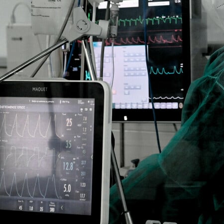 Πάτρα: 12χρονος πήγε να διαρρήξει διαμέρισμα και έπεσε από το μπαλκόνι - Νοσηλεύεται στη ΜΕΘ