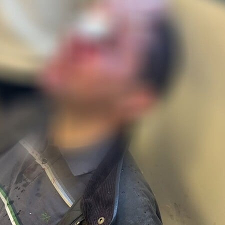 Εισβολή κουκουλοφόρων στη Νομική: Πώς έγινε η επίθεση - «Δεν έχω ξαναδεί τόση βία»