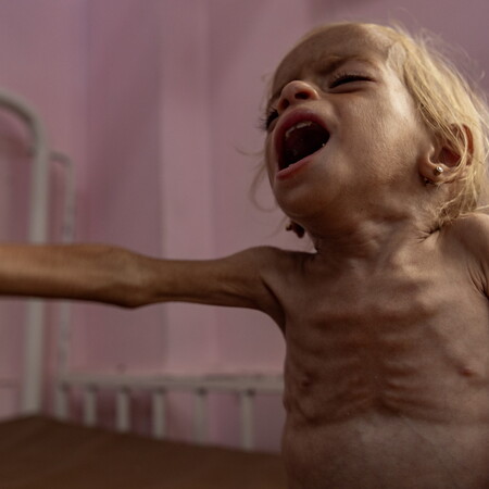 Λιμός στη Γάζα: Φορέας του ΟΗΕ επιβεβαιώνει για πρώτη φορά την πείνα