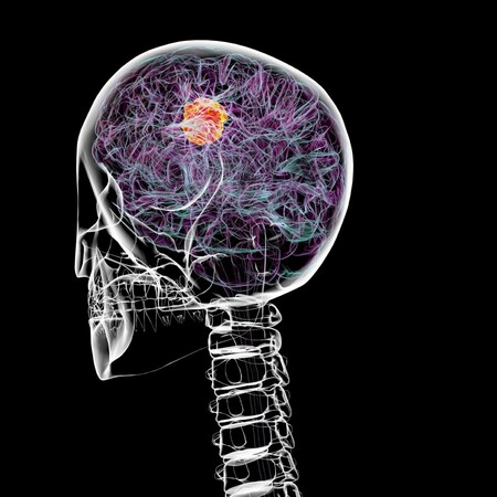 Ερευνητές του Cambridge «παγώνουν» μόριο-κλειδί και δίνουν μεγάλη ελπίδα για την αντιμετώπιση του καρκίνου στον εγκέφαλο